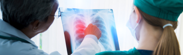 TB & Chest Department